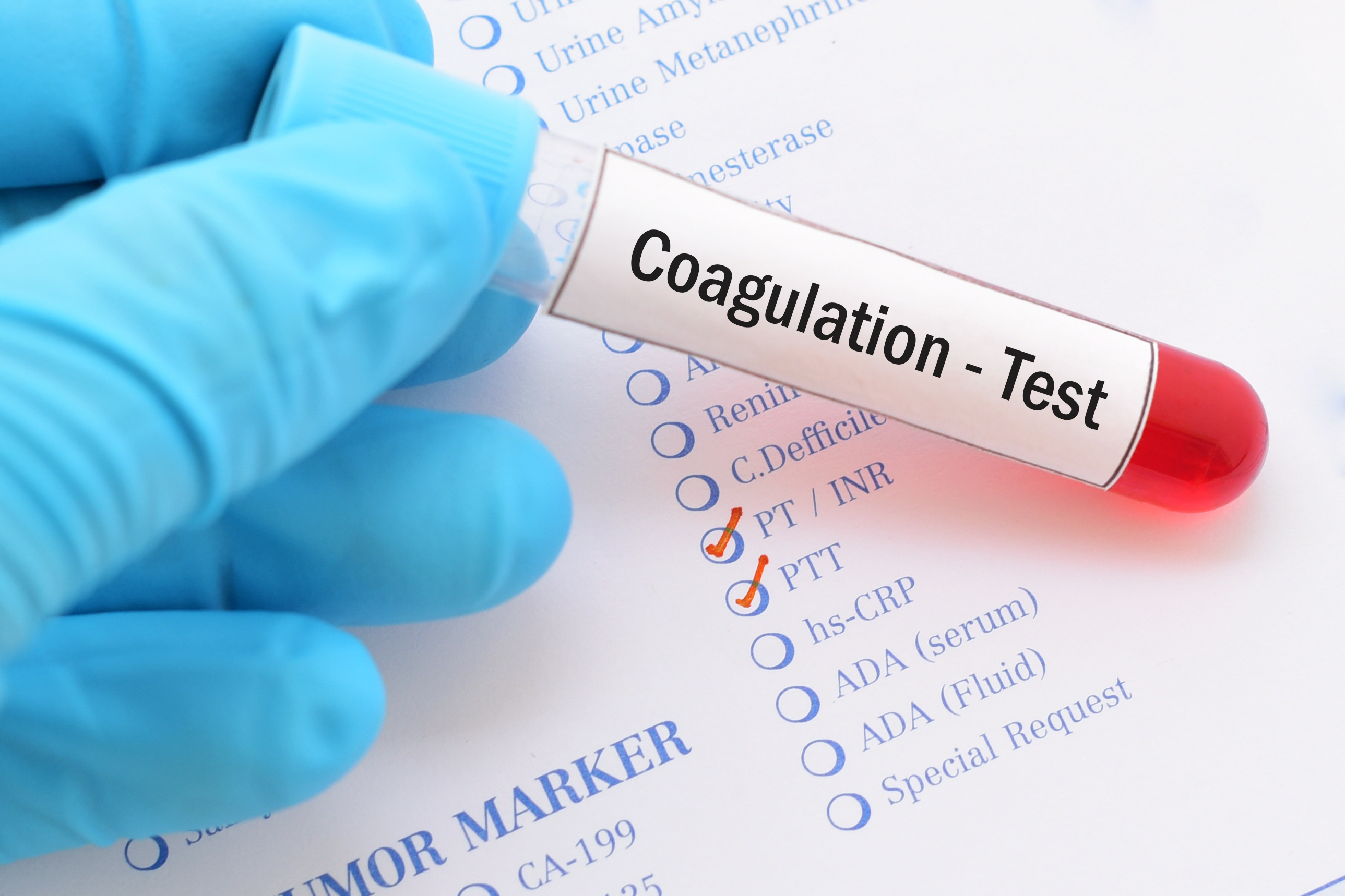Coagulation Diagnostic Training